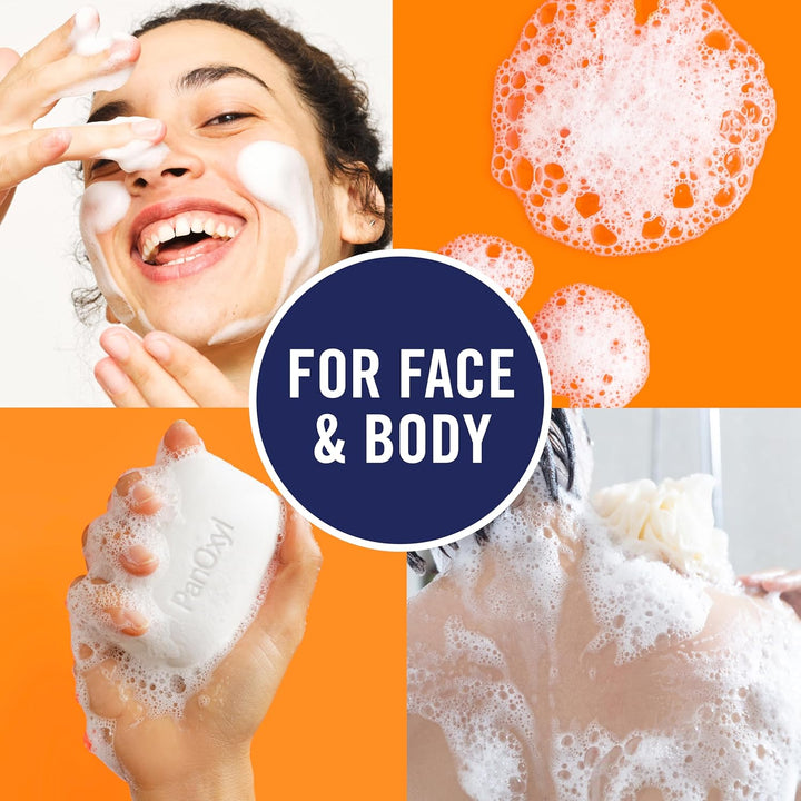 Panoxyl Acne Treatment Bar with 10% Benzoyl Peroxide, Maximum Strength Bar Soap for Face, Chest and Back, Benzoyl Peroxide Soap Body Wash, Vegan, for Acne Prone Skin, 4 Oz