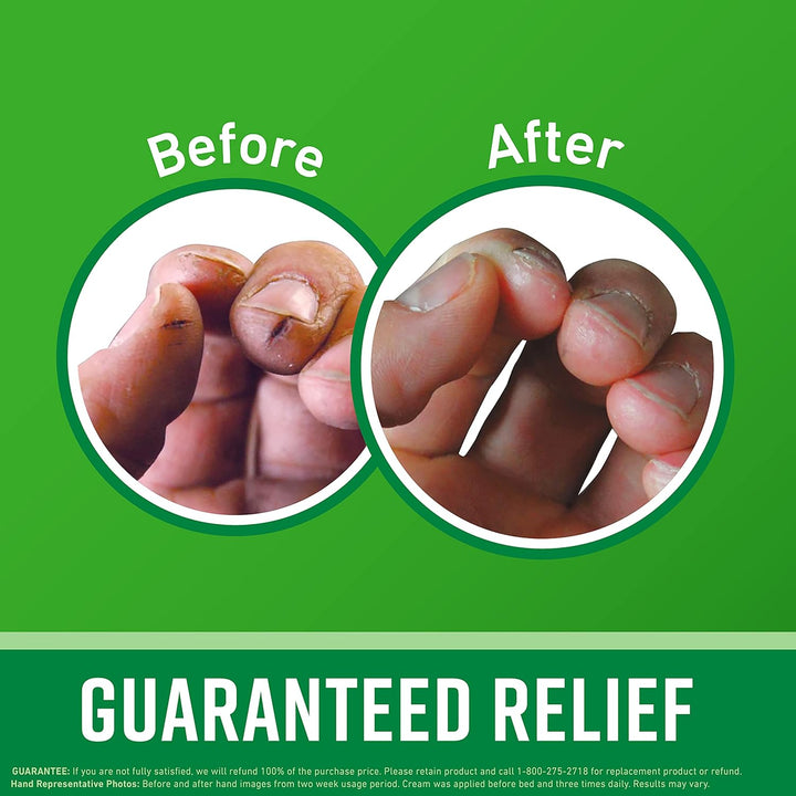 O'Keeffe'S Working Hands Hand Cream for Extreme Dryness - 3.4 Oz Jar (1 Pack) - Repairing Skincare for Cracked, Dry Hands